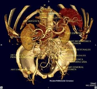 aorta_abdominal_visin_craneoant.jpg